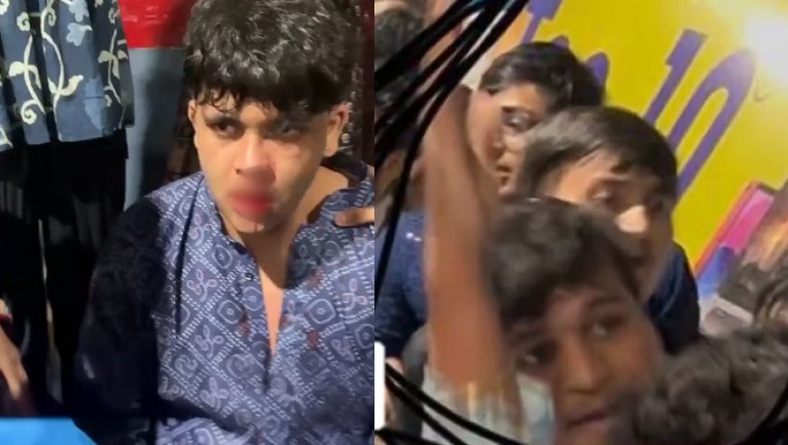 गोरेगांव ईस्ट नेस्को ग्राउंड गरबा में खूनी झगड़ा – 19 वर्षीय जेनिल बारबाया बुरी तरह घायल, सुरक्षा व्यवस्था पर उठे सवाल